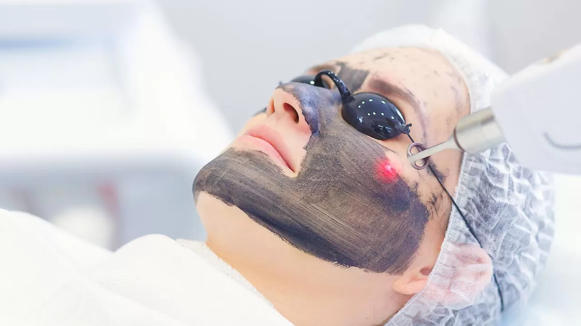 Obrazek Karbonový peeling